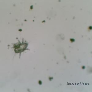Dust Mites
