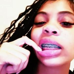Braceface (feat. Tyhollow)