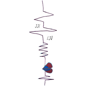 破碎Broken