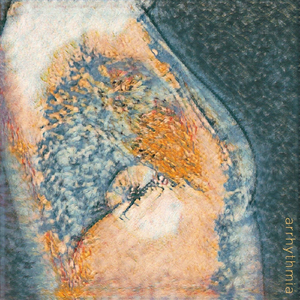 Arrhythmia