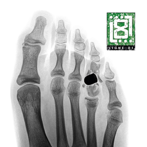 81 Problèmes
