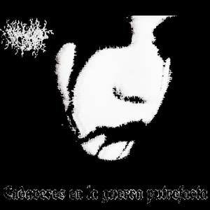 Muerte por sobredosis