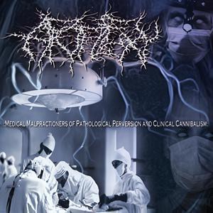 Suicide By Self-Disembowelment