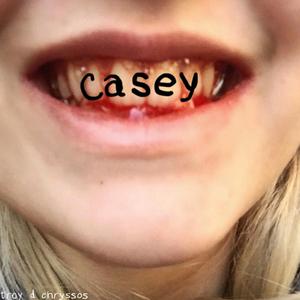 Casey