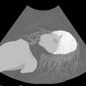 進化論、あるいは塵になって消えていく火の粉のような個体の孤独な革命について