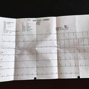 摘星计划（prod by.ChunLi128）