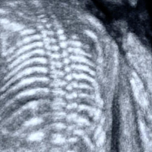 one day i'll tell him