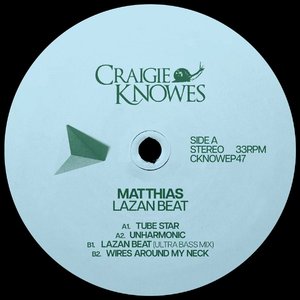 Wires Around My Neck