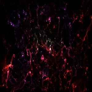 Hemorragia Consecuencia De La Verborragia