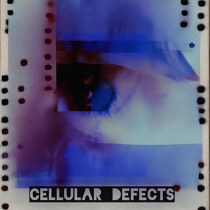 Encephalopathy