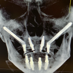 Wipe My Ass on Your Face