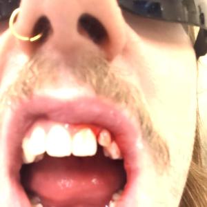 Mount Saint Helens Freestyle