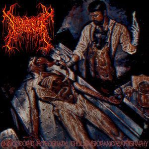 Cyclopentanoperhydrophenanthrene