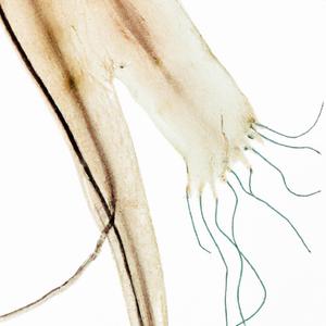 Hedonic Setpoint 15 (Short Version)