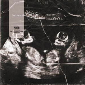 Fetus