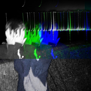 ADHD