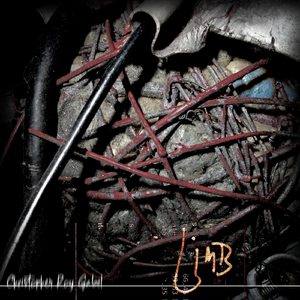 Conjoined Twins (The Sharing of One Set of Thoracic Vertebrae)