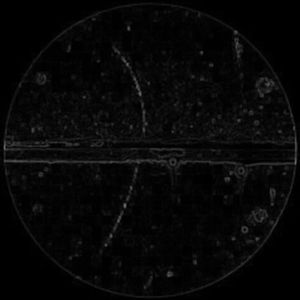 bipolar disorder（S）mix