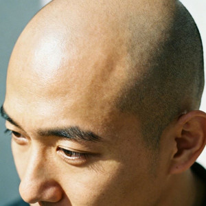 我的头光光