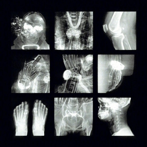 Anxiety（prod.金桔0RANG3）