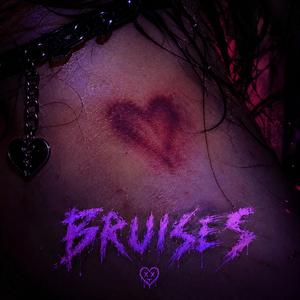 Bruises