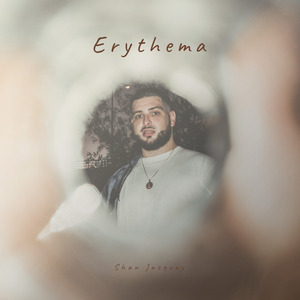 Erythema
