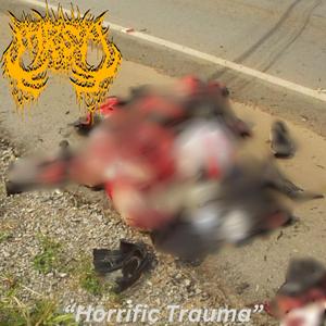 Pneumonoultramicroscopicsilicovolcanoconiosis