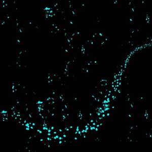 Cristales en mi interior