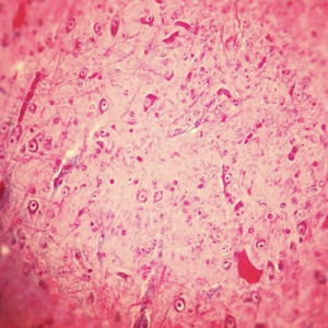 The Wind Is Struggling To Put Me Down