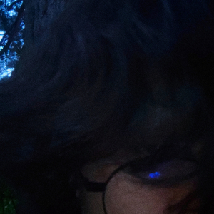 тахикардия