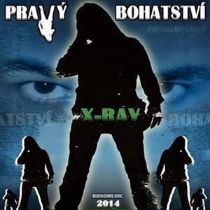 Citový tobogán (feat. Supa)