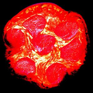 Keksulle tulee hallikulut (Voi eiii!)