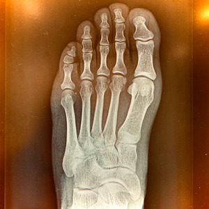 パンクバンドユー