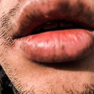 Dry