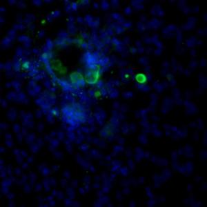 Ribosome (full protein)