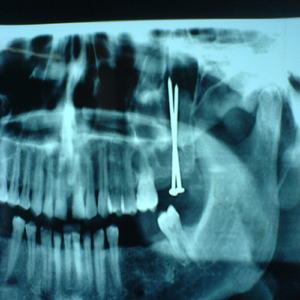 Space Concierto (For Keyboard and Orchestra)