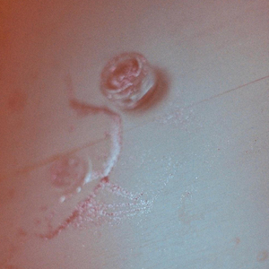 Rumore (From “Nasdrovia”)