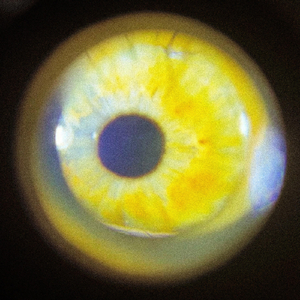 Impulsive