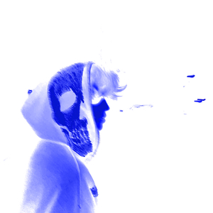 Underwent