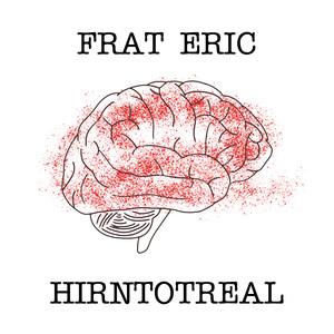 Hirntotreal