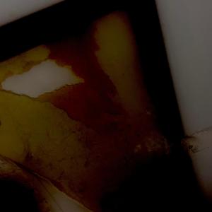 Alteration miraculous