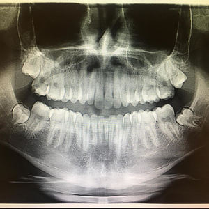 F.Y.F. (feat. Con-Way, Réz)