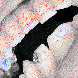 DIENTES