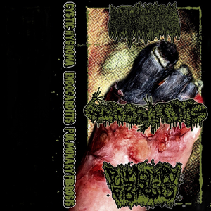 Mesothelial Neoplasms