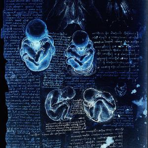 Death Trust (Revised)