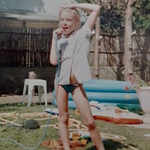 My Teeth Were Knocked Out