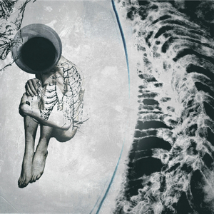 Электронный жук