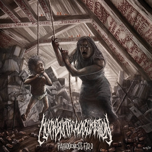 Debilitating Narcolepsy