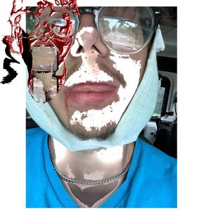 fu it up (Xannaholik Remix)