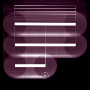 Alles nur aus Liebe (Loco & Jam Remix)